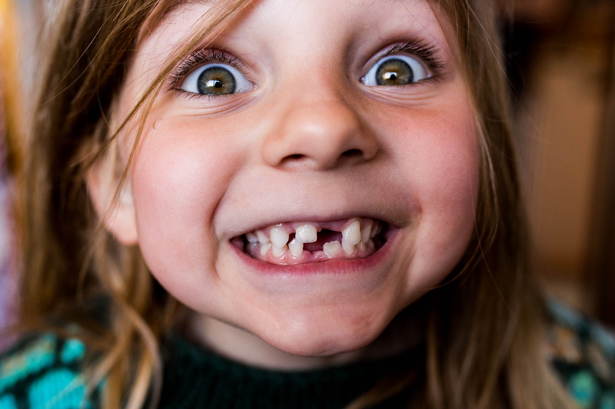 Portrait eines Mädchens mit Zahnlücke